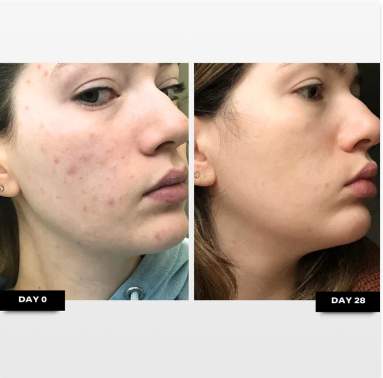 Retinal Clarity Serum