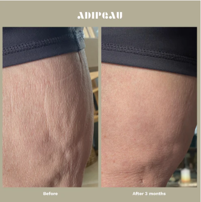 Strong Body Gel
