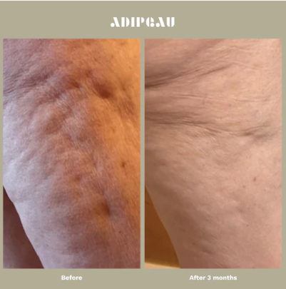 Strong Body Gel