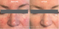 Hale Derma Spray